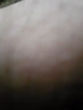 Snapshot of thesmiledoc chatting on October 2025 11:44:02 AM thesmiledoc online show from October 2025 11:44:02 AM